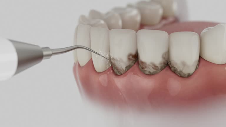 Reliable Dental Implants contractor in Kutztown, PA by Smile Center Dentistry